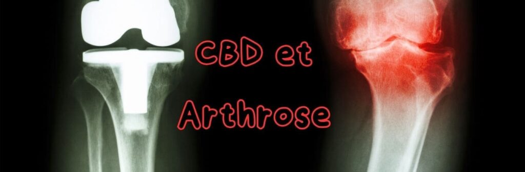 CBD et arthrose