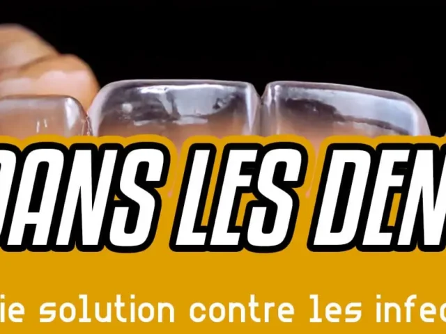 Le CBD dans les dentiers : une vraie solution contre les infections ?