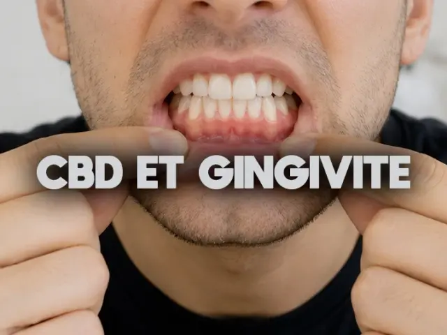 CBD et gingivite : ce que dit vraiment la recherche