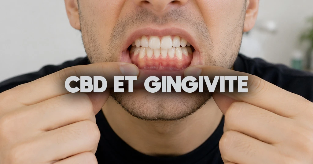 CBD et gingivite