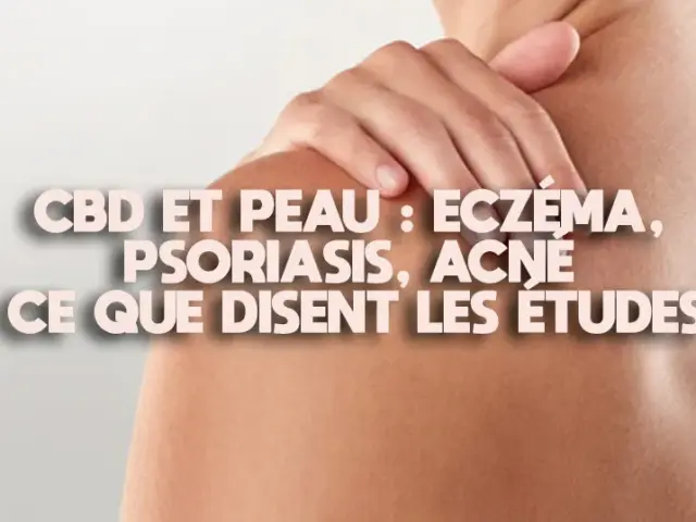 CBD et peau : eczéma, psoriasis, acné